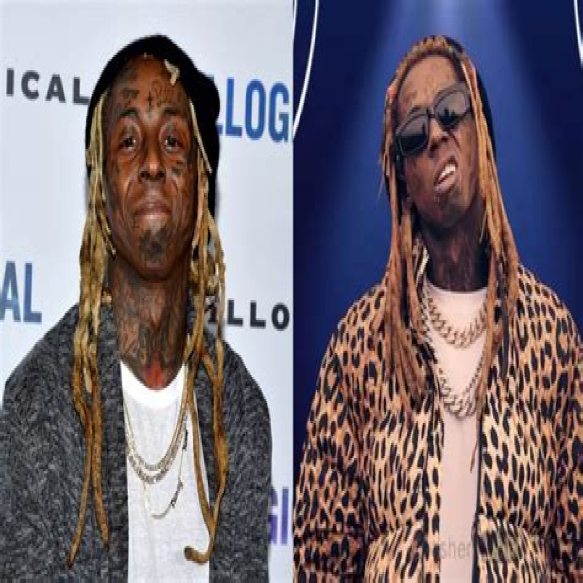 Lil Wayne Weight Gain Before and After: Who is Lil Wayne?